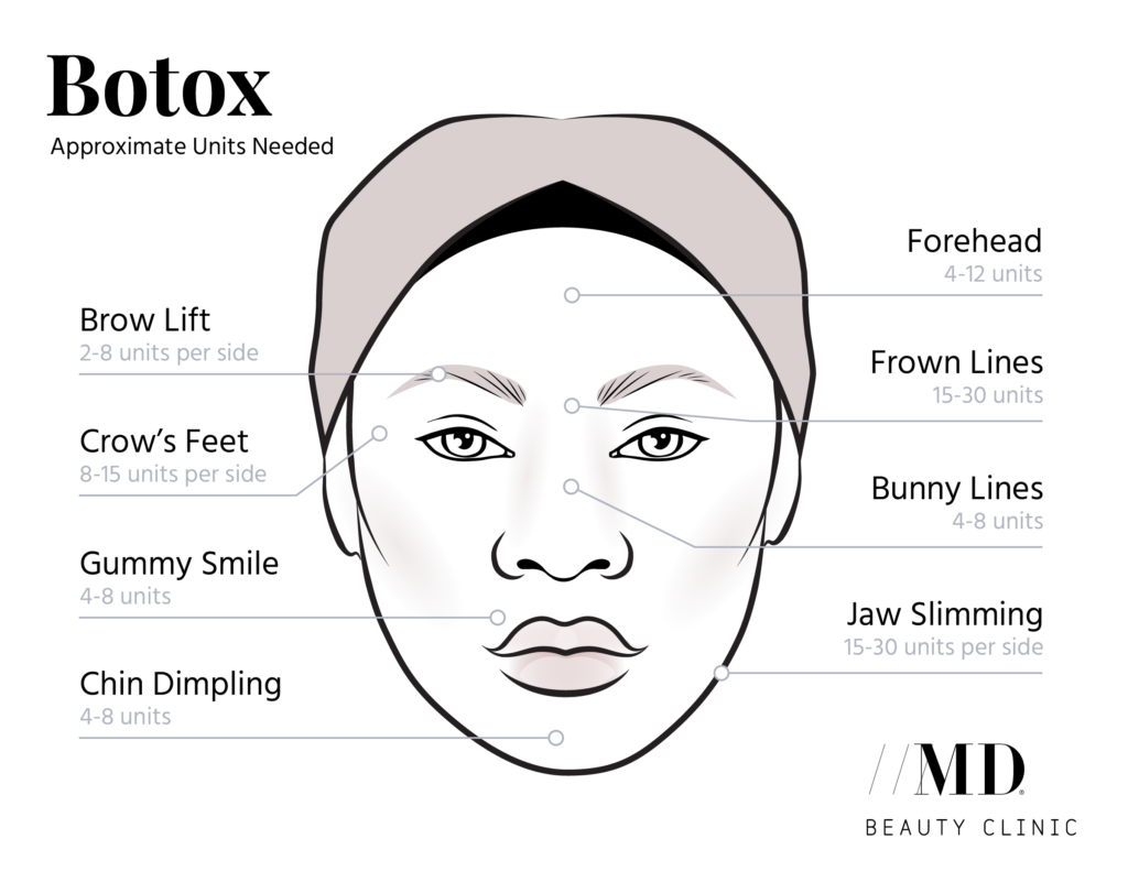 Botox vs. Filler: The Ultimate Guide | MD Beauty Clinic